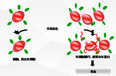 大咖零距离｜周虎教授谈阵发性睡眠性血红蛋白尿症（PNH）