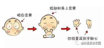 科普时间 | 溶血性贫血，怎么去黄？