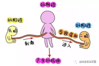 科普时间 | 溶血性贫血，怎么去黄？